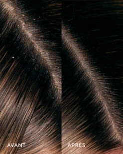 Huile Remède Cuir Chevelu Aceite De Moska -Dermalogica Boutique AvantapresCeremonia AceitedeMoska